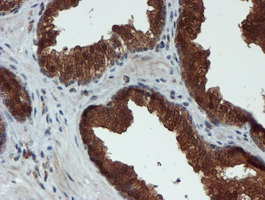 m07379 anti xtp4 mien1 mouse monoclonal antibody clone id oti2d2 ihc testing 8