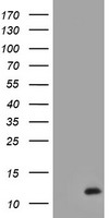 HEK293T cells were transfected with the pCMV6-ENTRY control (Left lane) or pCMV6-ENTRY C17orf37 (Right lane) cDNA for 48 hrs and lysed