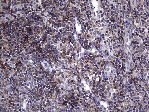 Immunohistochemical staining of paraffin-embedded Human tonsil within the normal limits using anti-AKAP7 Mouse monoclonal antibody