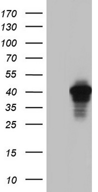 HEK293T cells were transfected with the pCMV6-ENTRY control (Left lane) or pCMV6-ENTRY AKAP7 (Right lane) cDNA for 48 hrs and lysed