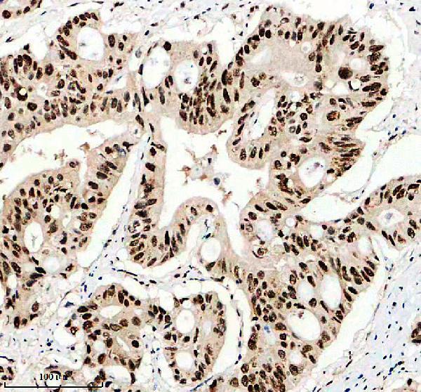 m07389 1 mettl14 primary antibodies ihc testing 1