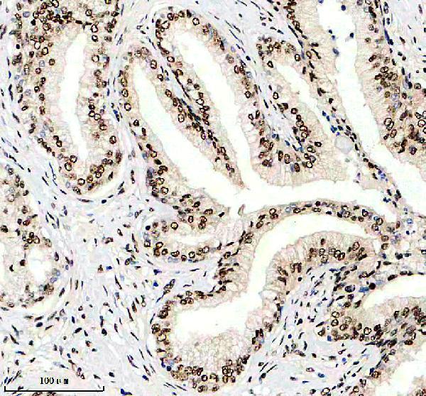 m07389 1 mettl14 primary antibodies ihc testing 2