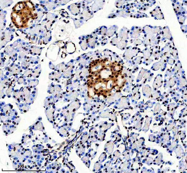 m07389 1 mettl14 primary antibodies ihc testing 3