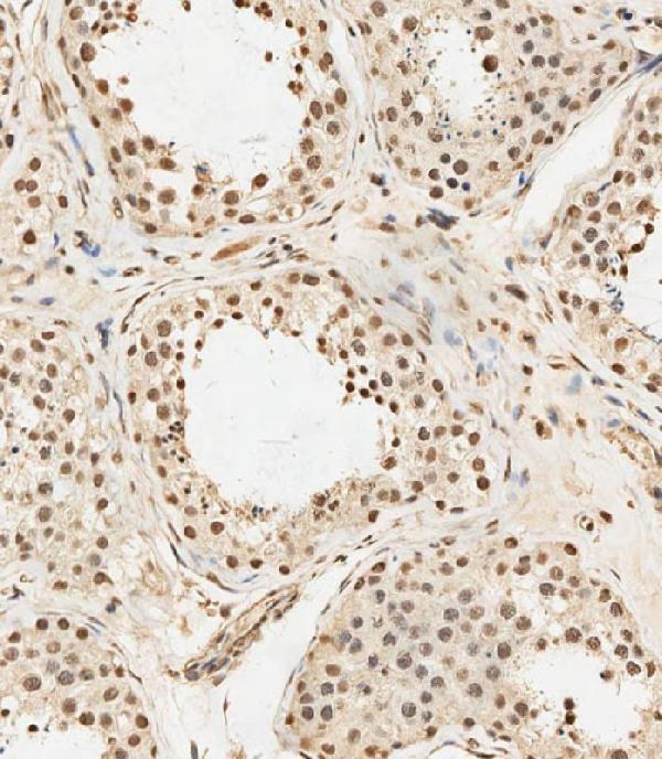 m07389 anti mettl14 antibody n term ihc p testing 2