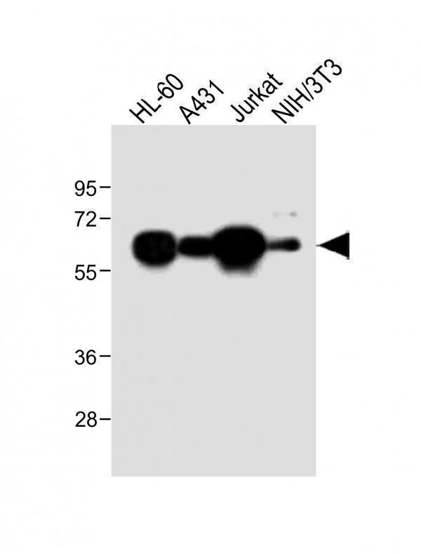 m07389 anti mettl14 antibody n term wb testing 1