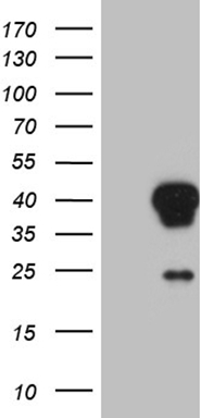 HEK293T cells were transfected with the pCMV6-ENTRY control (Left lane) or pCMV6-ENTRY AEBP2 (Right lane) cDNA for 48 hrs and lysed