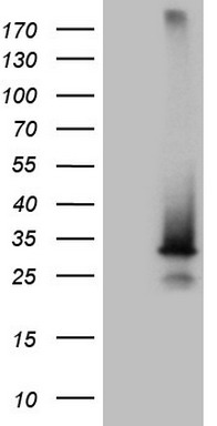 HEK293T cells were transfected with the pCMV6-ENTRY control (Left lane) or pCMV6-ENTRY SNX10 (Right lane) cDNA for 48 hrs and lysed. Equivalent amounts of cell lysates (5 ug per lane) were separated by SDS-PAGE and immunoblotted with anti-SNX10 (1:2000).