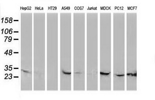 m07398 1 anti ctdsp1 mouse monoclonal antibody clone id oti1d3 wb testing 2