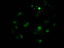 m07398 2 anti ctdsp1 mouse monoclonal antibody clone id oti1a10 if testing 3