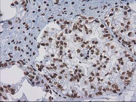 m07398 anti ctdsp1 mouse monoclonal antibody clone id oti1b6 ihc testing 2