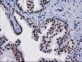 m07398 anti ctdsp1 mouse monoclonal antibody clone id oti1b6 ihc testing 3