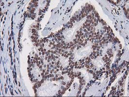 m07398 anti ctdsp1 mouse monoclonal antibody clone id oti1b6 ihc testing 4