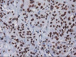 m07398 anti ctdsp1 mouse monoclonal antibody clone id oti1b6 ihc testing 5