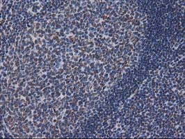 m07398 anti ctdsp1 mouse monoclonal antibody clone id oti1b6 ihc testing 6
