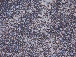 m07398 anti ctdsp1 mouse monoclonal antibody clone id oti1b6 ihc testing 7