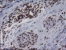 m07398 anti ctdsp1 mouse monoclonal antibody clone id oti1b6 ihc testing 8