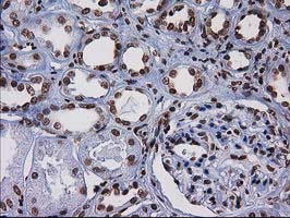m07398 anti ctdsp1 mouse monoclonal antibody clone id oti1b6 ihc testing 9