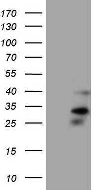HEK293T cells were transfected with the pCMV6-ENTRY control (Left lane) or pCMV6-ENTRY ORAI2 (Right lane) cDNA for 48 hrs and lysed