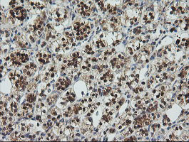 m07427 anti ube2g2 mouse monoclonal antibody clone id oti1b10 ihc testing 11