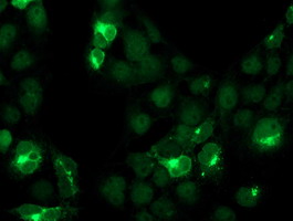 m07438 anti cystatin s cst4 mouse monoclonal antibody clone id oti2h10 if testing 4
