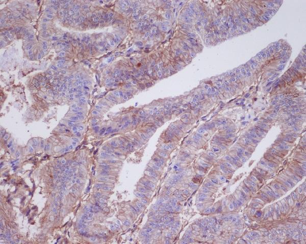 m07442 ihc