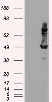 m07455 anti hippi ift57 mouse monoclonal antibody clone id oti4f6 wb testing 1