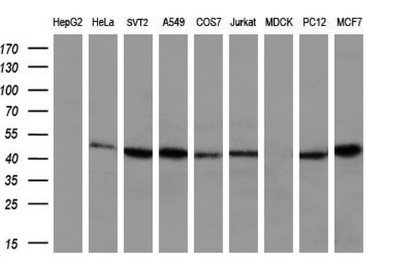 m07455 anti hippi ift57 mouse monoclonal antibody clone id oti4f6 wb testing 2