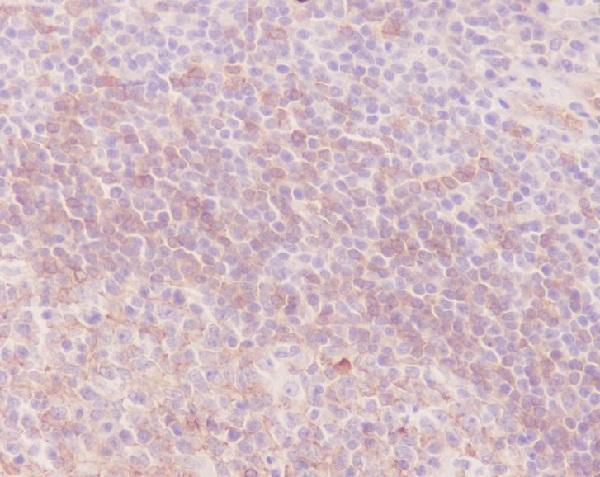 Immunohistochemical analysis of paraffin-embedded Human tonsil, using Human IgM Antibody