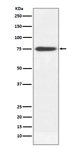 Western blot analysis of Human IgM expression in human plasma lysate
