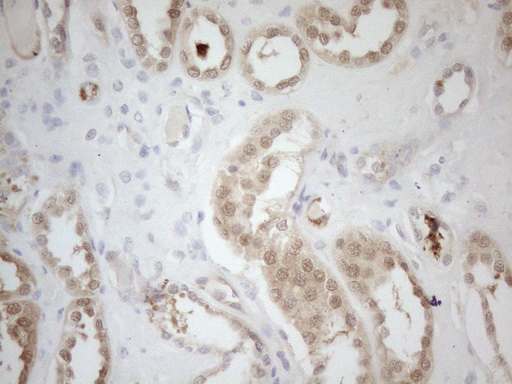 m07473 anti rps6kc1 mouse monoclonal antibody clone id oti10f11 ihc testing 2