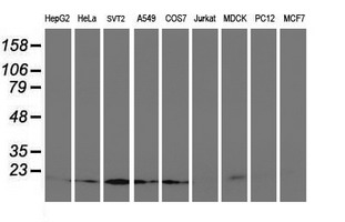 Western blot analysis of extracts (35ug) from 9 different cell lines by using anti-UBE2M monoclonal antibody