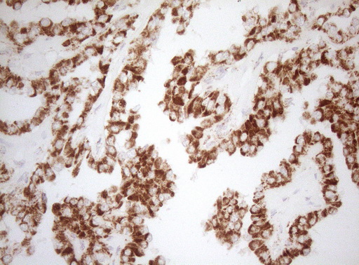 m07482 1 anti decr1 mouse monoclonal antibody clone id oti4g4 ihc testing 4