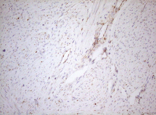 m07482 1 anti decr1 mouse monoclonal antibody clone id oti4g4 ihc testing 5