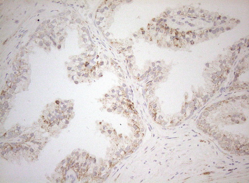 m07482 1 anti decr1 mouse monoclonal antibody clone id oti4g4 ihc testing 6