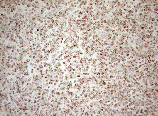 m07482 1 anti decr1 mouse monoclonal antibody clone id oti4g4 ihc testing 8