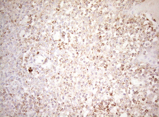 m07482 1 anti decr1 mouse monoclonal antibody clone id oti4g4 ihc testing 9