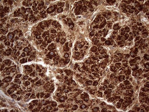 m07482 anti decr1 mouse monoclonal antibody clone id oti5d6 ihc testing 3