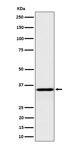 Western blot analysis of Pyrophosphatase 1 expression in HepG2 cell lysate