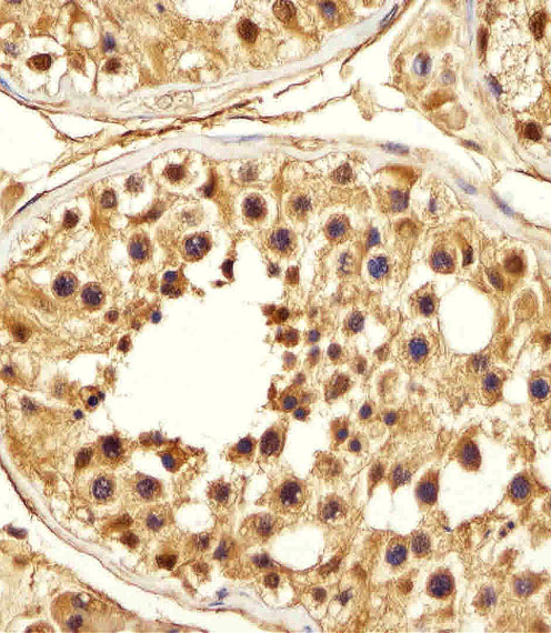 m07499 anti psma5 antibody ihc p testing 4