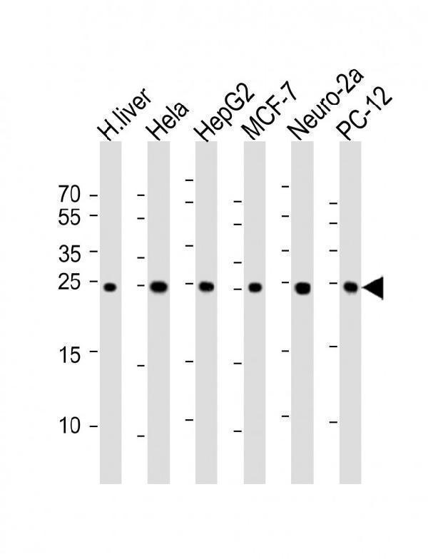 All lanes : Anti-PSMA5 Antibody at 1:1000 dilutionLane 1: human liver lysateLane 2: Hela whole cell lysateLane 3: HepG2 whole cell lysateLane 4: MCF-7 whole cell lysateLane 5: Neuro-2a whole cell lysateLane 6: PC-12 whole cell lysateLysates/proteins at 20 μg per lane