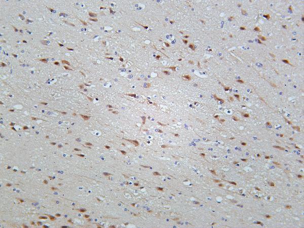 Human brain was stained with Anti-TBR1 rabbit antibody