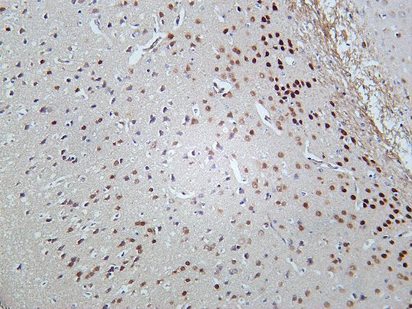 Mouse brain was stained with Anti-TBR1 rabbit antibody