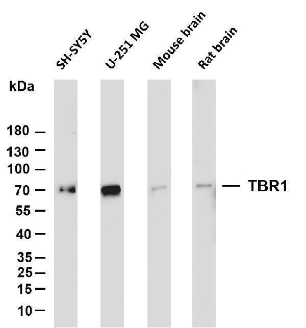 Various whole cell lysates were separated by 4-20% SDS-PAGE, and the membrane was blotted with anti-TBR1 antibody