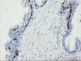 Immunohistochemical staining of paraffin-embedded Human prostate tissue within the normal limits using anti-FOXI1 mouse monoclonal antibody