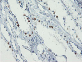 Immunohistochemical staining of paraffin-embedded Human Kidney tissue within the normal limits using anti-FOXI1 mouse monoclonal antibody