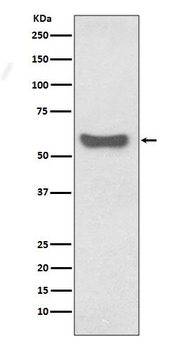 Western blot analysis of IgA expression in human plasma lysate