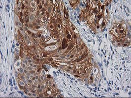 m07524 anti serpinb4 mouse monoclonal antibody clone id oti4c8 ihc testing 2
