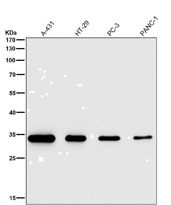 All lanes use the Antibody at 1:2K dilution for 1 hour at room temperature