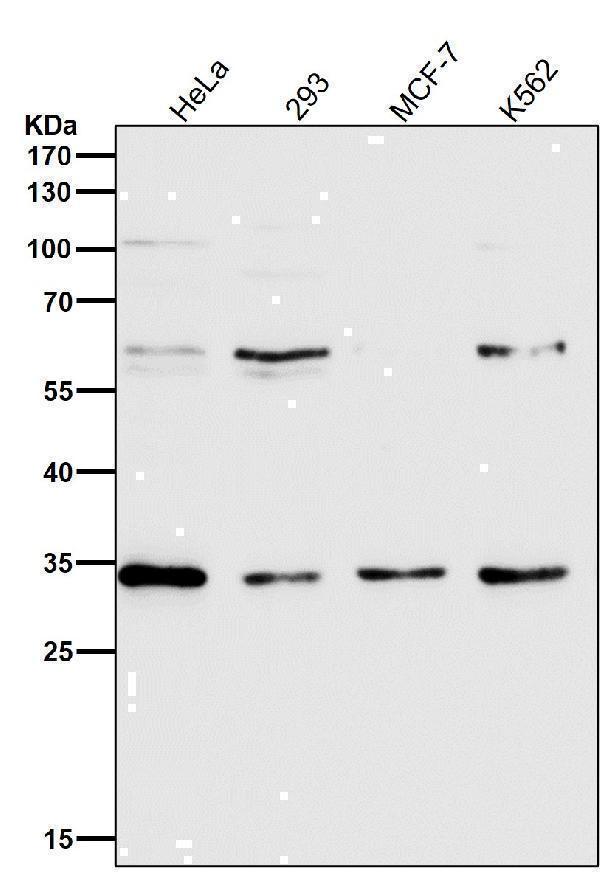 All lanes use the Antibody at 1:2K dilution for 1 hour at room temperature