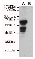 Western blotting validation for Anti-Akt1 PXK Monoclonal Antibody M07555
Western blot detection of AKT1 in CHO-K1 cell lysate (B) and CHO-K1 transfected by AKT1 (A) cell lysate using AKT1 mouse mAb (1:1000 diluted)